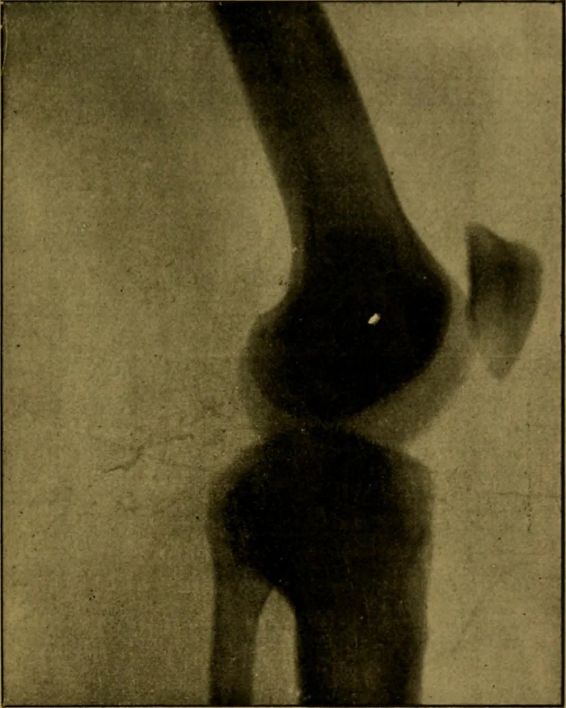 An illustration from La photographie de l'invisible : les rayons X suivi d'un glossaire, 1898, leaf 138