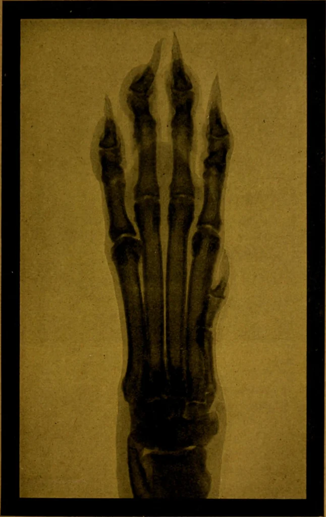 An illustration from La photographie de l'invisible : les rayons X suivi d'un glossaire, 1898, leaf 144
