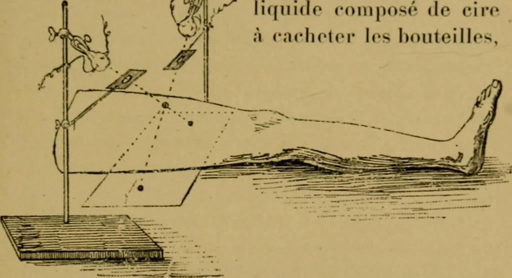 An illustration from La photographie de l'invisible : les rayons X suivi d'un glossaire, 1898, leaf 152