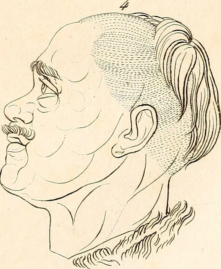 An illustration from L'art de connaitre les hommes par la physionomie, 1806, leaf 140