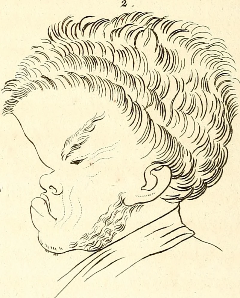 An illustration from L'art de connaitre les hommes par la physionomie, 1806, leaf 149