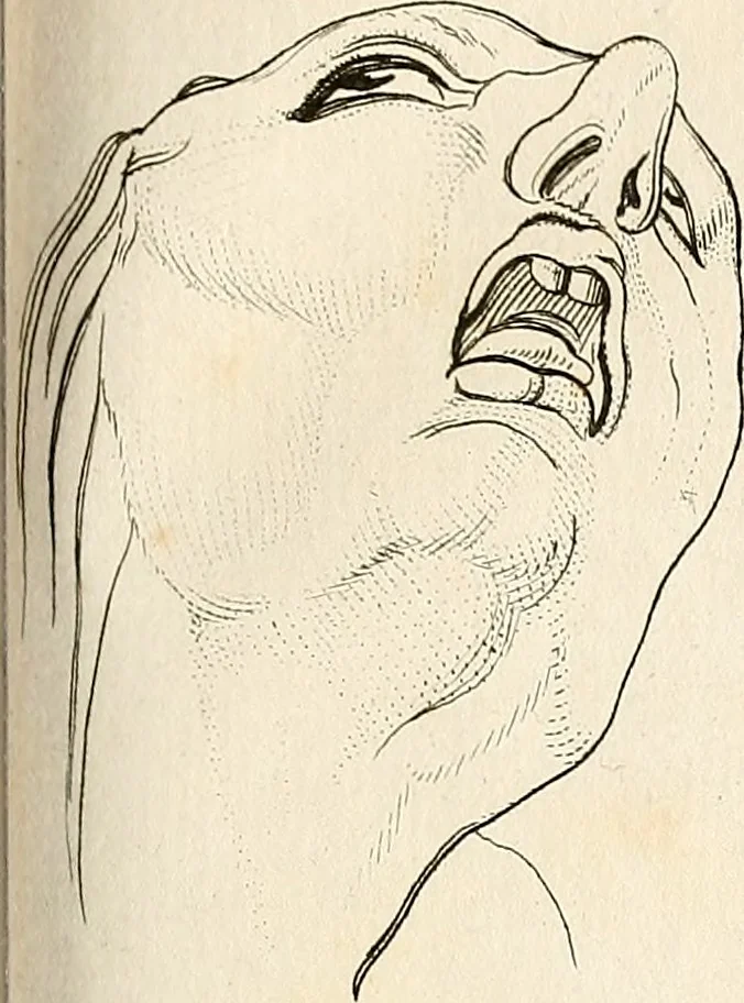 An illustration from L'art de connaitre les hommes par la physionomie, 1806, leaf 472