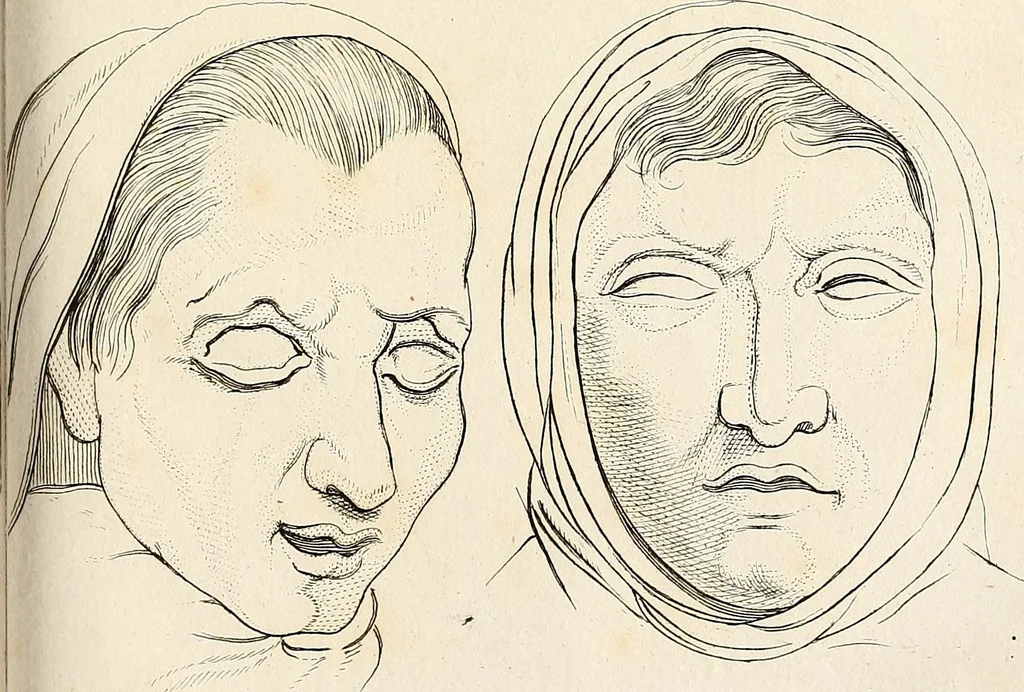 An illustration from L'art de connaitre les hommes par la physionomie, 1806, leaf 472