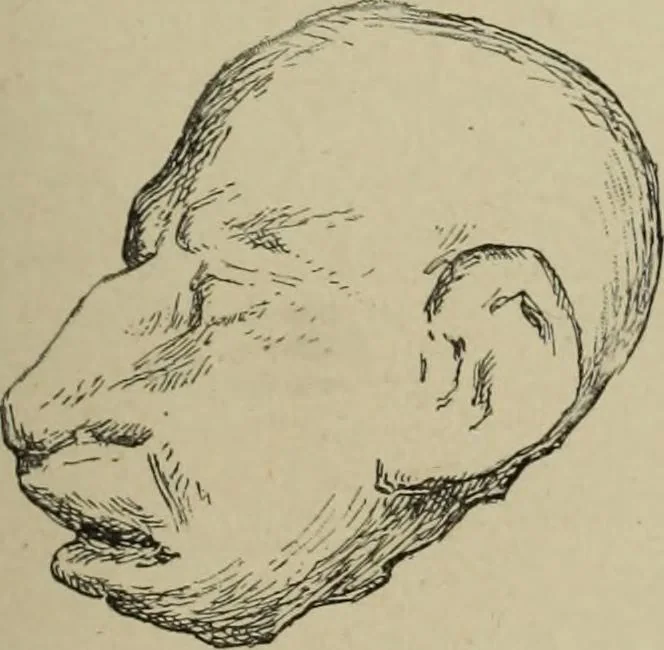 An illustration from L'art du rire et de la caricature, 1892, leaf 22