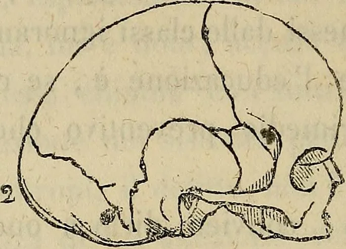 An illustration from L'arte de conoscere gli uomini : il piccolo Lavater e Dottor Gall, 1865, leaf 325