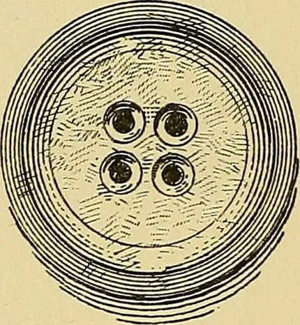 An illustration from La suggestibilité, 1900, leaf 267
