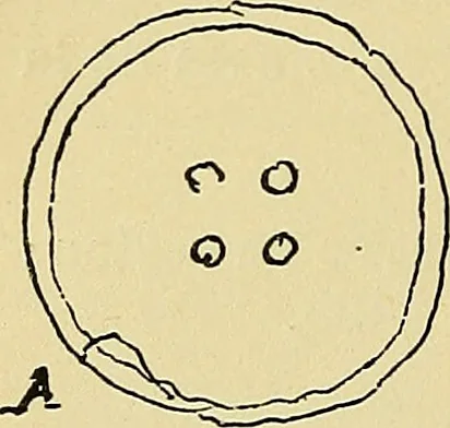 An illustration from La suggestibilité, 1900, leaf 325