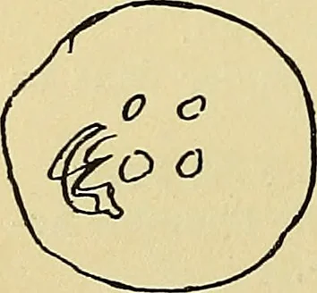 An illustration from La suggestibilité, 1900, leaf 325