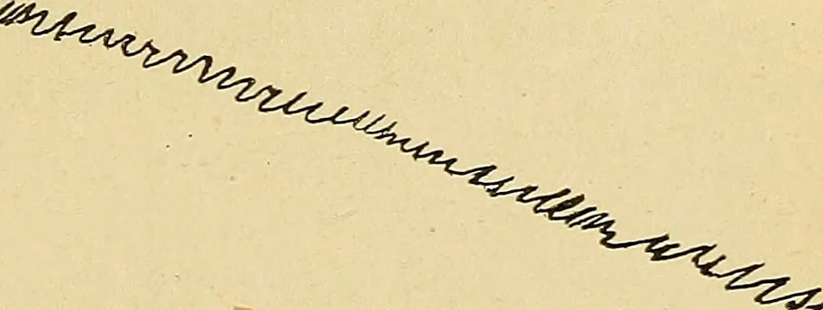 An illustration from La suggestibilité, 1900, leaf 396