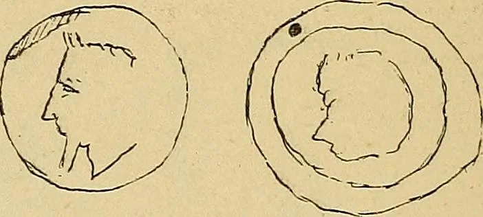 An illustration from La suggestibilité, 1900, leaf 325