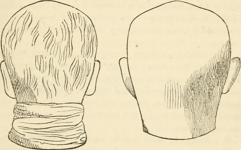 An illustration from Lectures on phrenology, including its application to the present and prospective condition of the United States, 1840, leaf 142