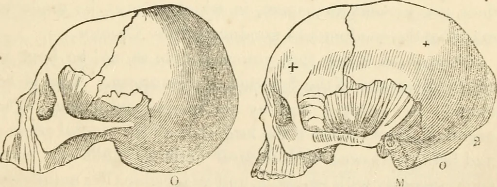 An illustration from Lectures on phrenology, including its application to the present and prospective condition of the United States, 1840, leaf 142