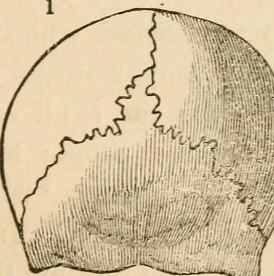 An illustration from Lectures on phrenology, including its application to the present and prospective condition of the United States, 1840, leaf 154