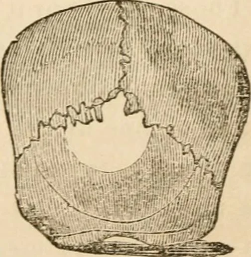 An illustration from Lectures on phrenology, including its application to the present and prospective condition of the United States, 1840, leaf 154