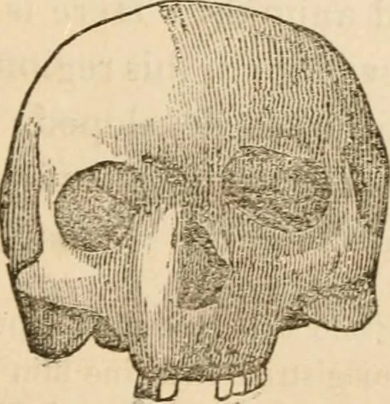 An illustration from Lectures on phrenology, including its application to the present and prospective condition of the United States, 1840, leaf 160