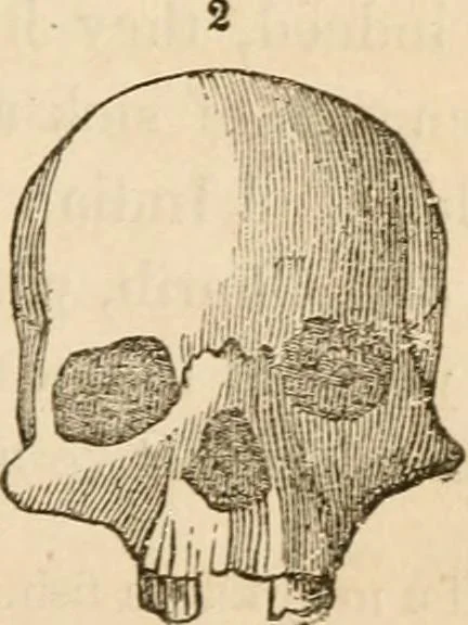 An illustration from Lectures on phrenology, including its application to the present and prospective condition of the United States, 1840, leaf 160