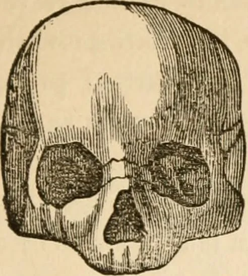 An illustration from Lectures on phrenology, including its application to the present and prospective condition of the United States, 1840, leaf 178