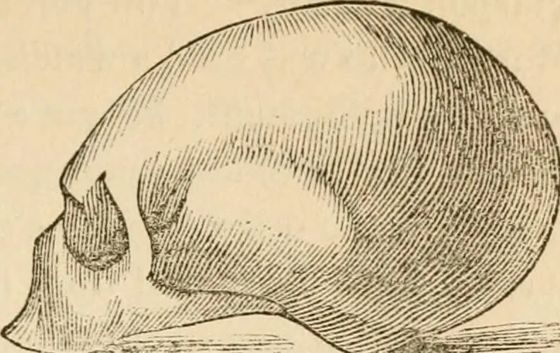 An illustration from Lectures on phrenology, including its application to the present and prospective condition of the United States, 1840, leaf 178