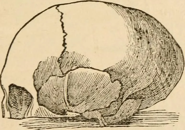 An illustration from Lectures on phrenology, including its application to the present and prospective condition of the United States, 1840, leaf 36
