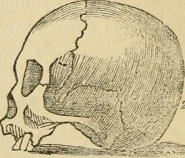 An illustration from Lectures on phrenology, including its application to the present and prospective condition of the United States, 1840, leaf 37
