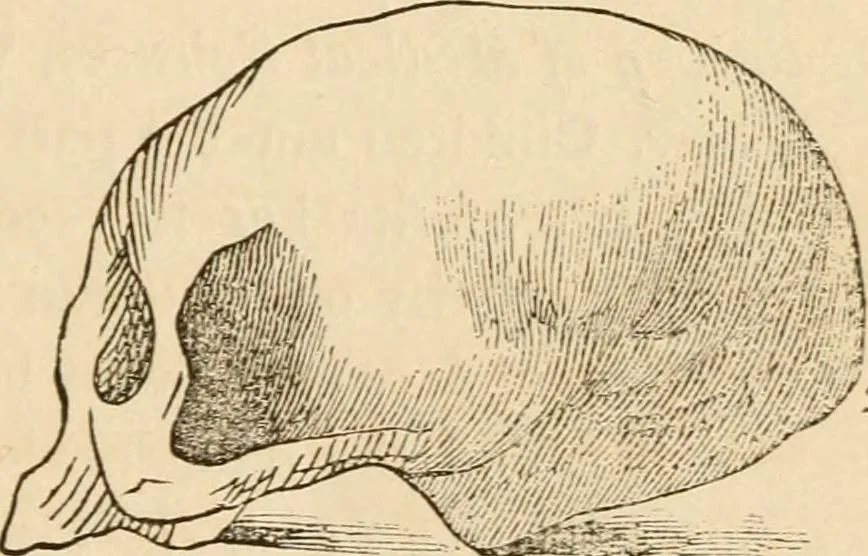 An illustration from Lectures on phrenology, including its application to the present and prospective condition of the United States, 1840, leaf 44