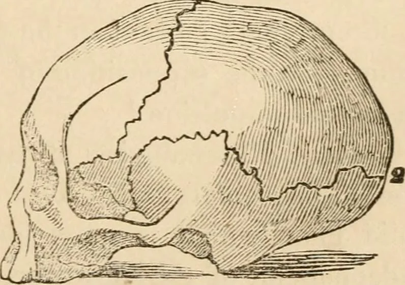 An illustration from Lectures on phrenology, including its application to the present and prospective condition of the United States, 1840, leaf 44