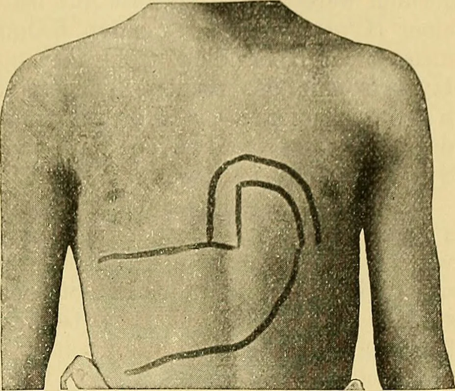 An illustration from Lehrbuch der Krankheiten des Herzens und der Blutgefässe, 1906, leaf 206