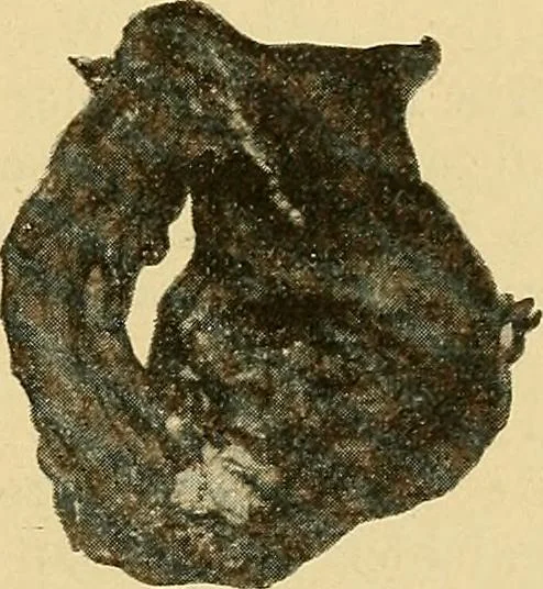An illustration from Lehrbuch der Krankheiten des Herzens und der Blutgefässe, 1906, leaf 210
