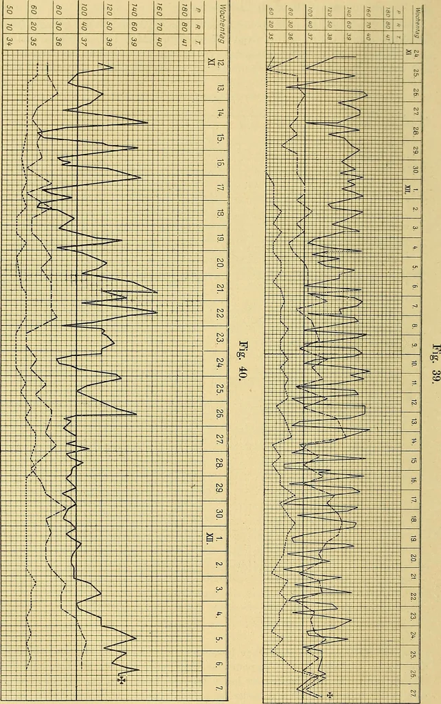 An illustration from Lehrbuch der Krankheiten des Herzens und der Blutgefässe, 1906, leaf 371