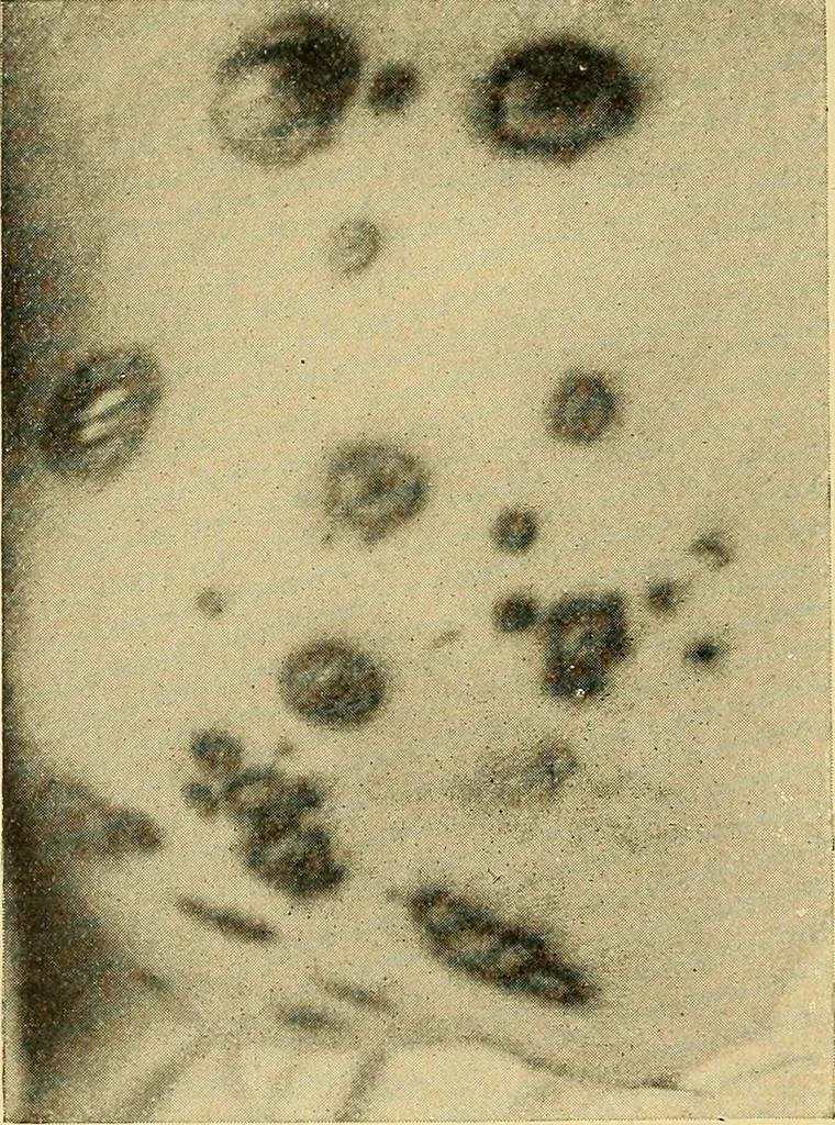 An illustration from Lehrbuch der Krankheiten des Herzens und der Blutgefässe, 1906, leaf 375