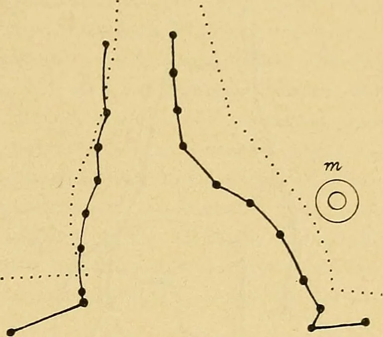 An illustration from Lehrbuch der Krankheiten des Herzens und der Blutgefässe, 1906, leaf 38