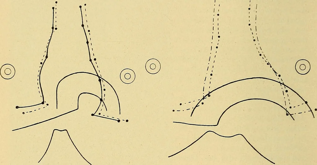 An illustration from Lehrbuch der Krankheiten des Herzens und der Blutgefässe, 1906, leaf 39