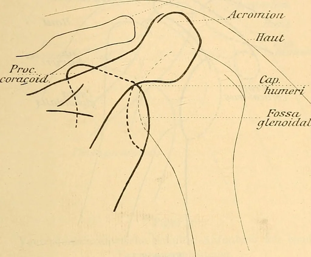 An illustration from Leitfaden des Röntgen-Verfahrens, 1903, leaf 204