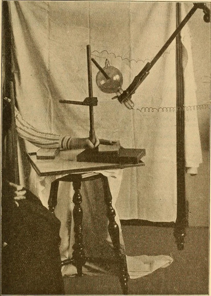 An illustration from Leitfaden des Röntgen-Verfahrens, 1903, leaf 210
