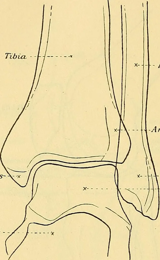 An illustration from Leitfaden des Röntgen-Verfahrens, 1903, leaf 215