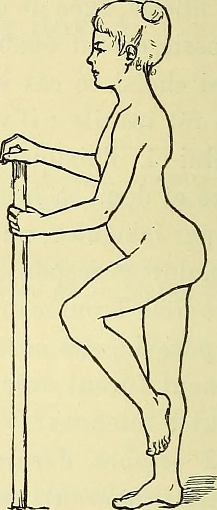 An illustration from Leçons cliniques de chirurgie infantile : deuxième série, 1905, leaf 141