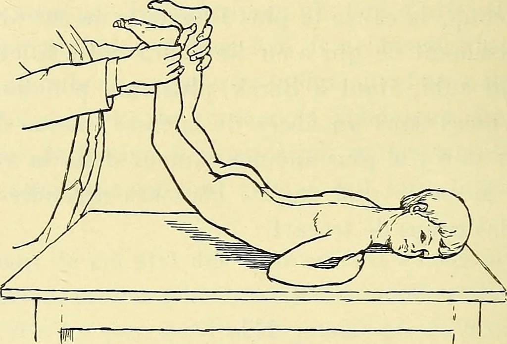 An illustration from Leçons cliniques de chirurgie infantile : deuxième série, 1905, leaf 145