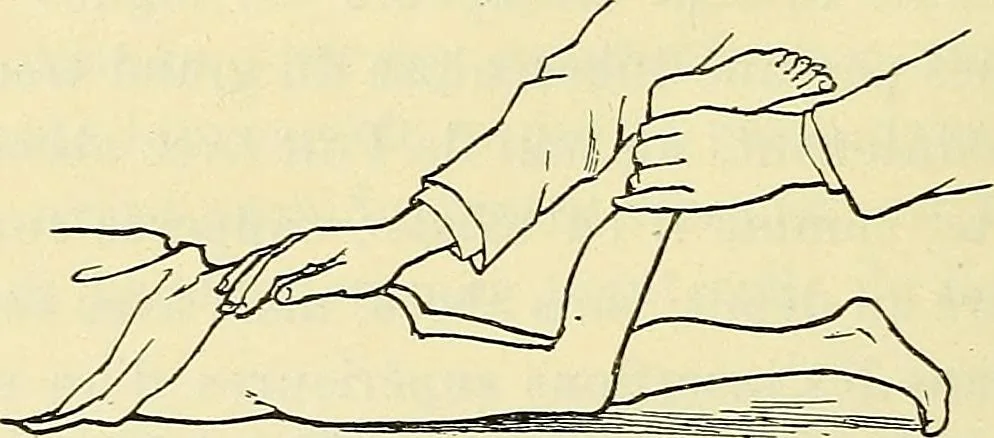 An illustration from Leçons cliniques de chirurgie infantile : deuxième série, 1905, leaf 145