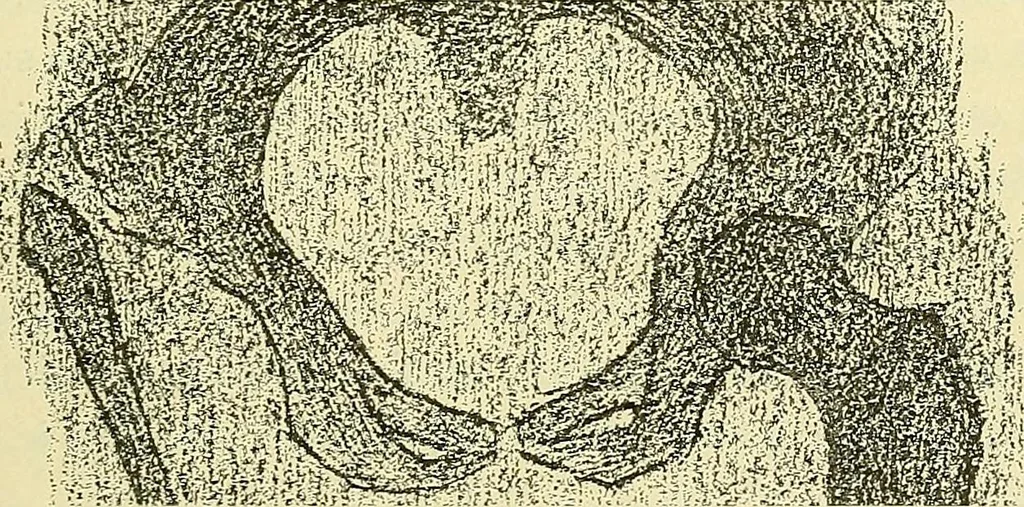 An illustration from Leçons cliniques de chirurgie infantile : deuxième série, 1905, leaf 204