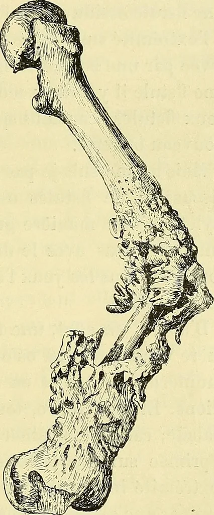 An illustration from Leçons cliniques de chirurgie infantile : deuxième série, 1905, leaf 270