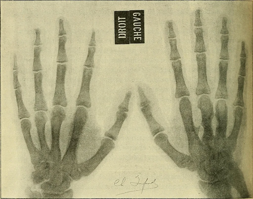 An illustration from Leçons cliniques de chirurgie infantile : deuxième série, 1905, leaf 309