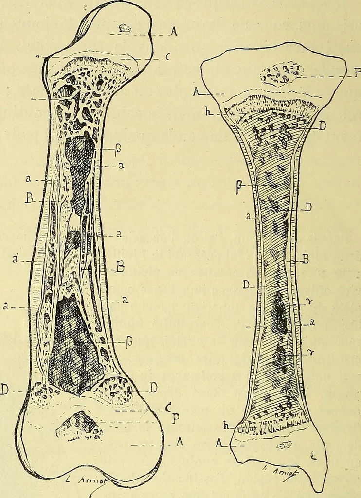 An illustration from Leçons cliniques de chirurgie infantile : deuxième série, 1905, leaf 33