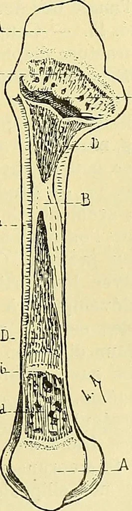 An illustration from Leçons cliniques de chirurgie infantile : deuxième série, 1905, leaf 34