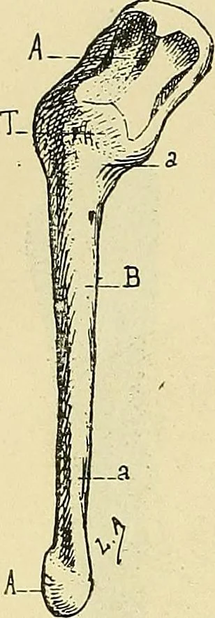 An illustration from Leçons cliniques de chirurgie infantile : deuxième série, 1905, leaf 35