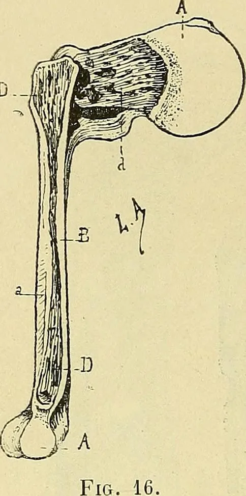 An illustration from Leçons cliniques de chirurgie infantile : deuxième série, 1905, leaf 35
