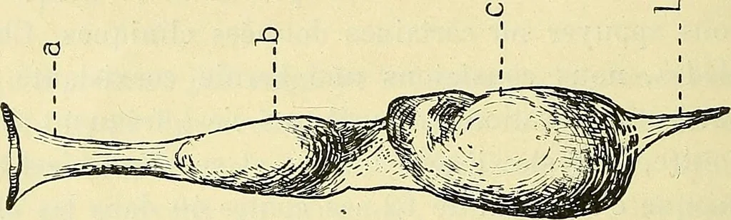 An illustration from Leçons cliniques de chirurgie infantile : deuxième série, 1905, leaf 391
