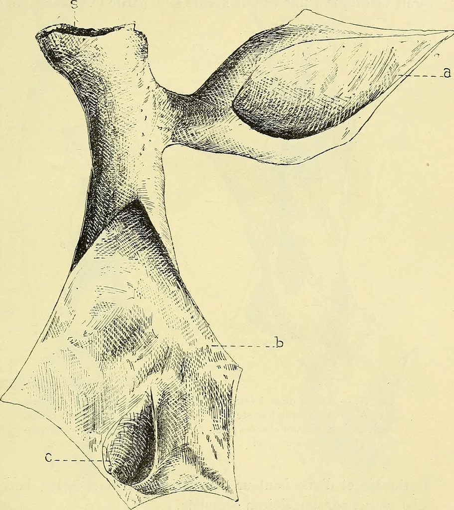 An illustration from Leçons cliniques de chirurgie infantile : deuxième série, 1905, leaf 392