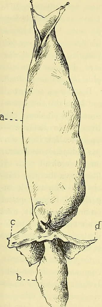 An illustration from Leçons cliniques de chirurgie infantile : deuxième série, 1905, leaf 394