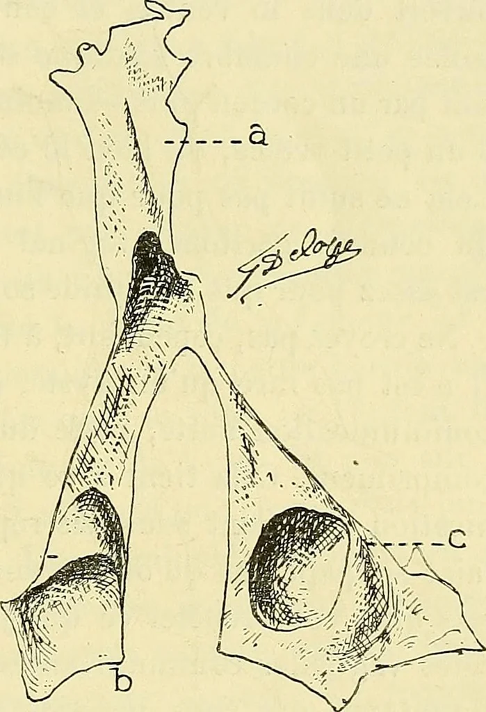 An illustration from Leçons cliniques de chirurgie infantile : deuxième série, 1905, leaf 398