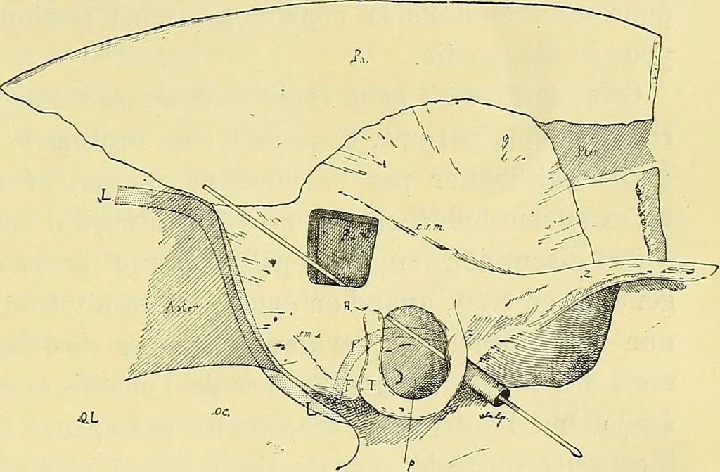 An illustration from Leçons cliniques de chirurgie infantile : deuxième série, 1905, leaf 566